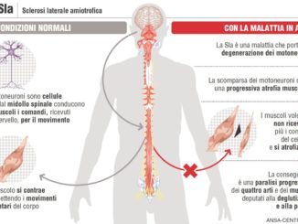giornata nazionale per la SLA